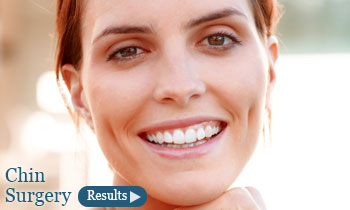 Chin Surgery in Torrance, CA