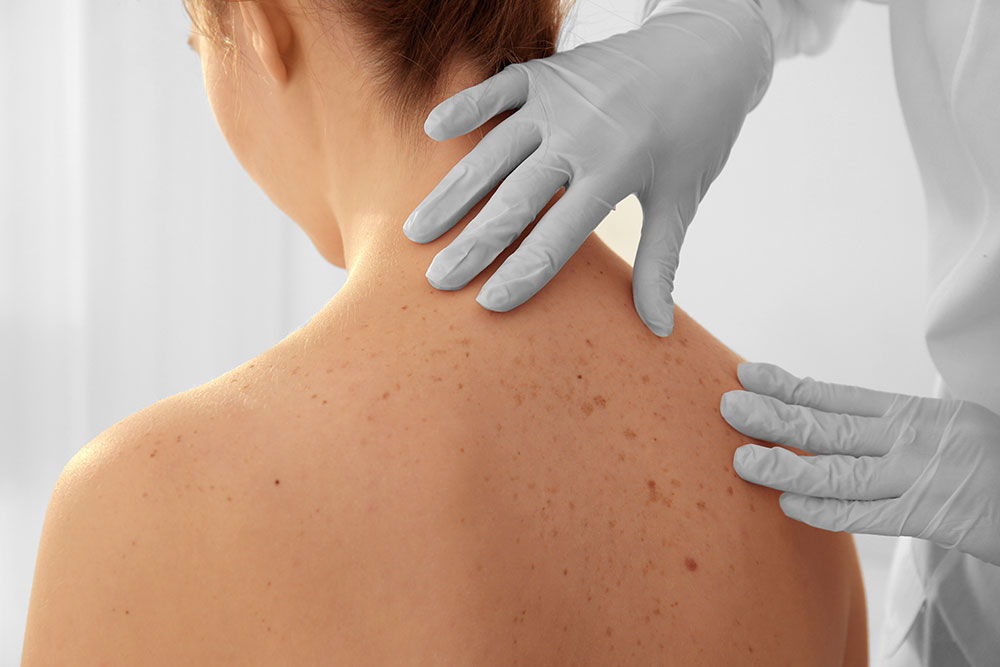 Dermatologist examining patient in clinic